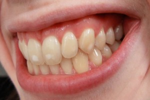 dientes-630x420